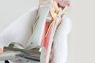 【特別掲載】アキレス腱断裂・腱炎・周囲炎に対する吊性・置性転子の非観血的処置について